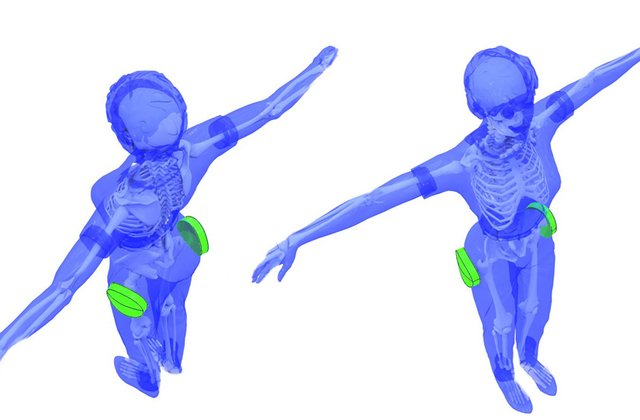 smart pill box with alarms