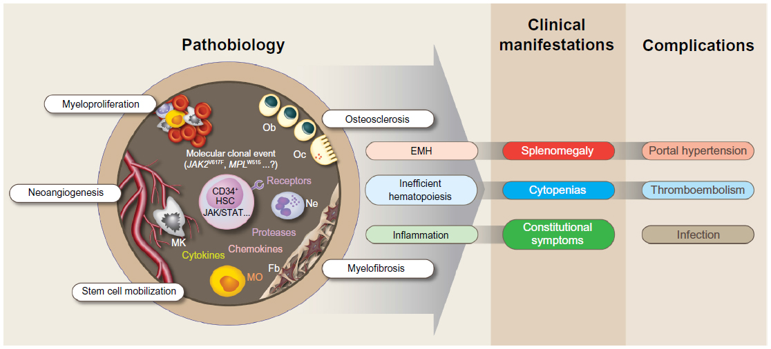 How Myelofibrosis Affects Your Body | Med-Q Pill Dispenser